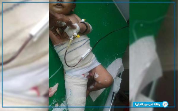 مليشيا الحوثي تقصف المدنيين في حيس وإصابة طفل
