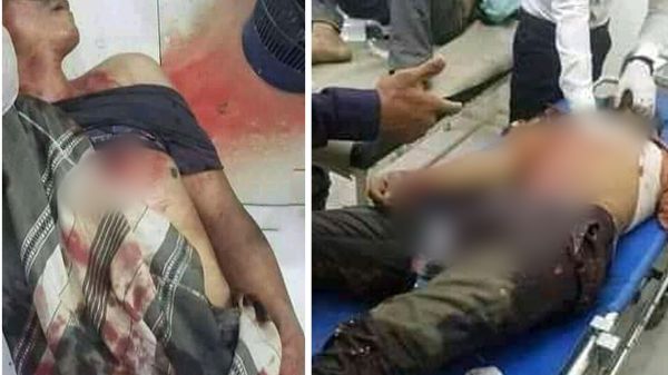 شهيدان ومثلهما جرحى في قصف حوثي على مناطق سكنية بتعز 