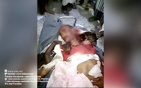 "سعيد سالم" شهيدًا برصاص قناصة المليشيا بضواحي حيس