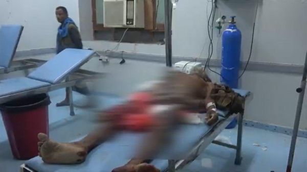 حقوق الإنسان بالحديدة: مليشيا الحوثي ارتكبت عشرات الجرائم في 3 مديريات 