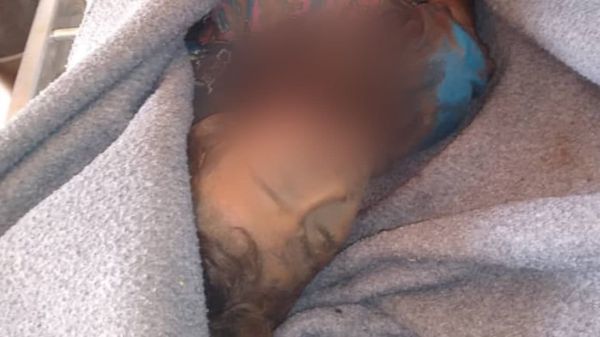 "حقوق الإنسان" بالدريهمي يدين المجزرة البشعة التي ارتكبتها مليشيا الحوثي بالمديرية