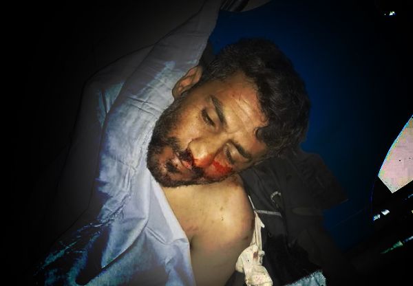 طالب براتبه.. مليشيا الحوثي تقتل مدرسًا في عمران 