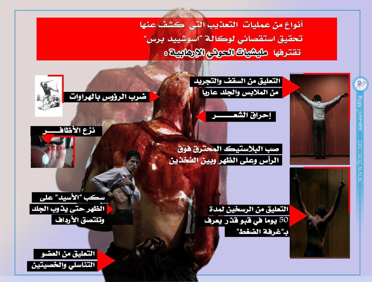 إنفوجرافيك| أصناف التعذيب الوحشي بحق المعتقلين في سجون مليشيا الحوثي