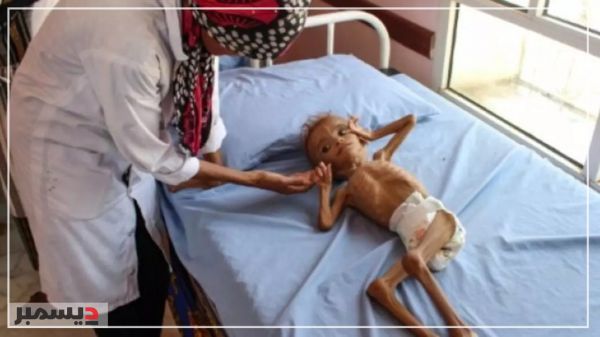 وكالات الأمم المتحدة: نافذة منع عودة المجاعة إلى اليمن تغلق بسرعة