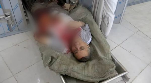 استشهاد لاعب ونجله في تعز بقصف للحوثيين على ملعب كرة قدم