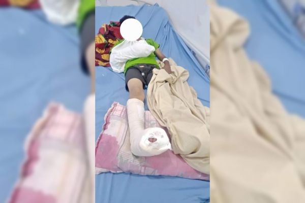 الضالع.. إصابة طفلين بانفجار مقذوف حوثي في "حجر"