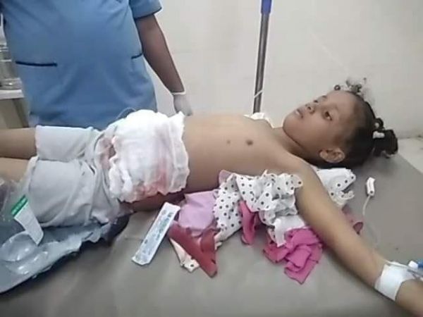 أغلبهم أطفال.. ارتفاع حصيلة ضحايا القصف الحوثي في تعز إلى 7 قتلى وجرحى خلال 24 ساعة 