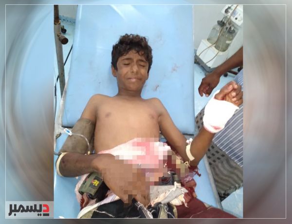 إصابة طفل بانفجار مقذوف من مخلفات مليشيا الحوثي في التحيتا