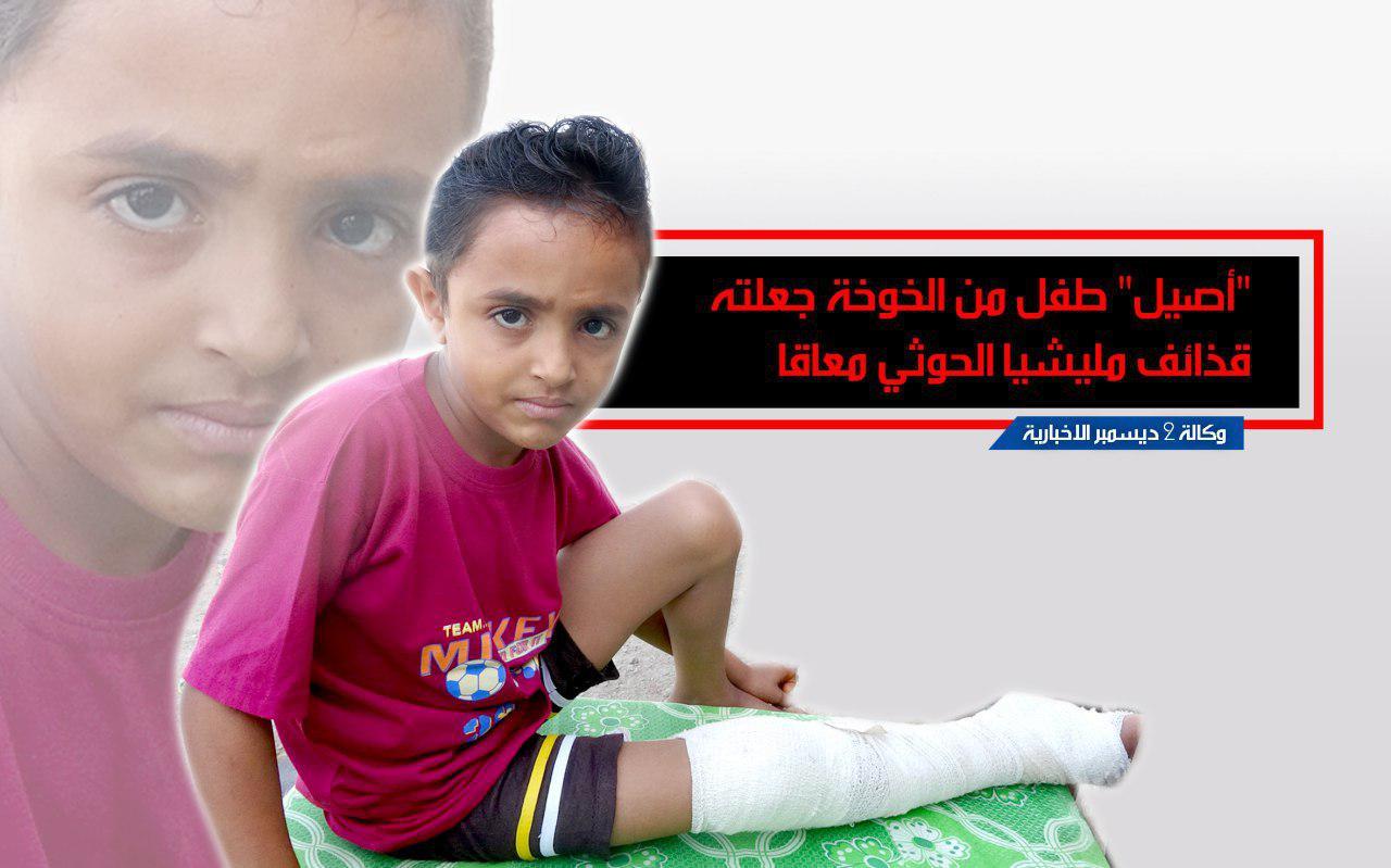 «أصيل» طفل قيدت مليشيا الحوثي أحلامه بقذائفها