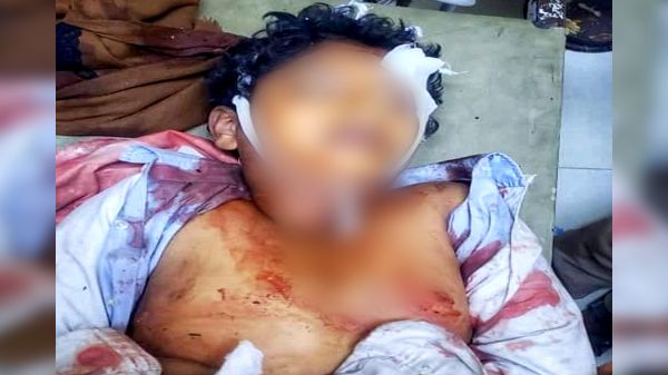 مليشيا الحوثي الإرهابية تقتل طفلاً برصاص قناصاتها شمالي تعز  