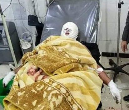 إب.. انتحار شاب حرقاً والعثور على جثة آخر مشنوقة 