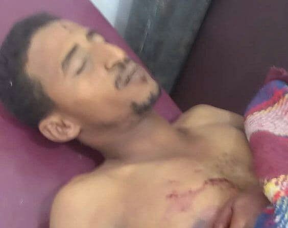 مليشيا الحوثي تصفي أحد المهمشين وتصيب آخرين لرفضهم القتال معها 